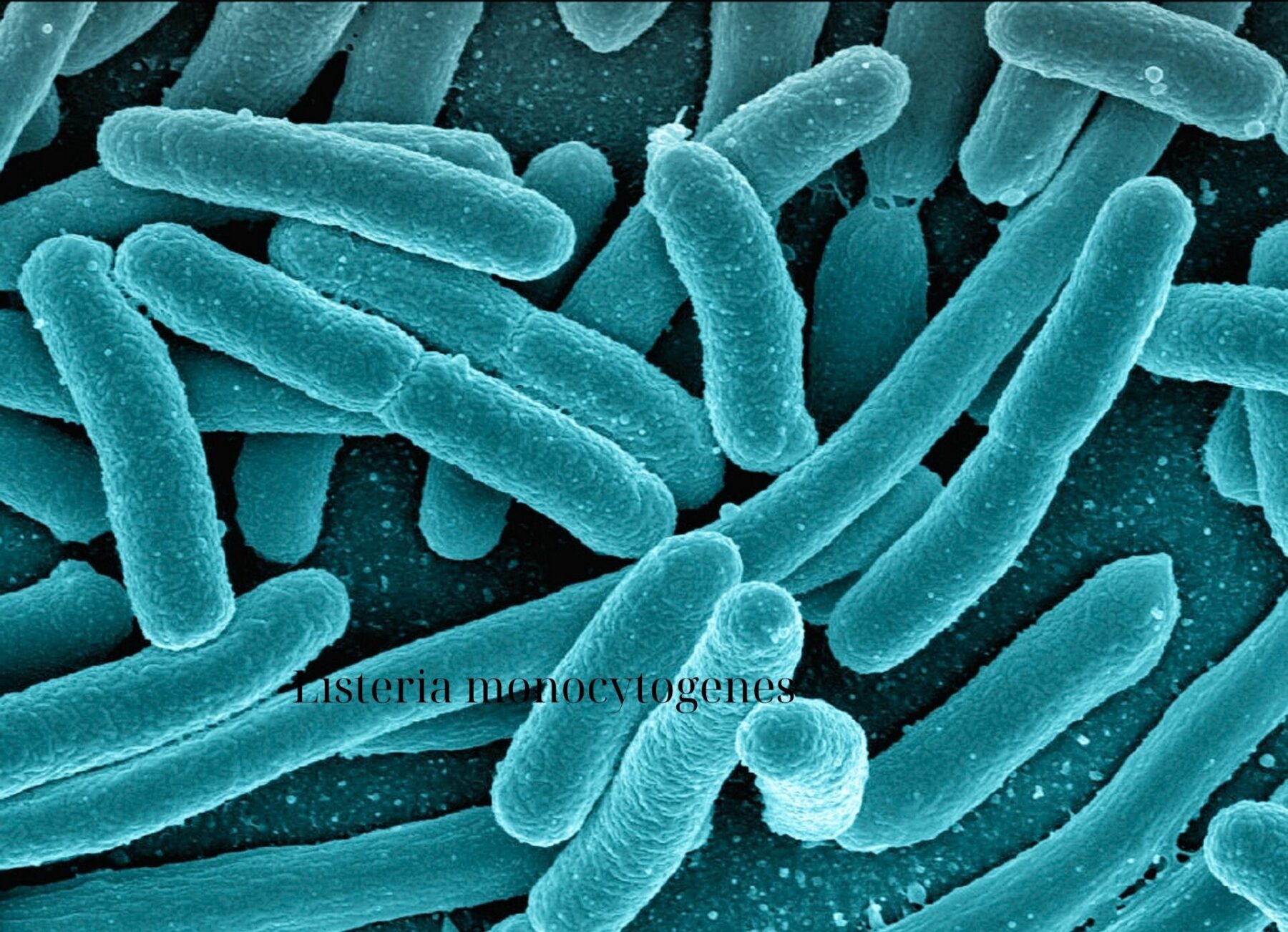 Ημερίδα – Workshop για τη Listeria monocytogenes
